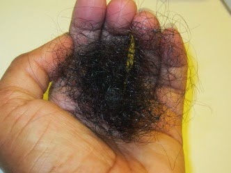 Hair Breakage and Causes