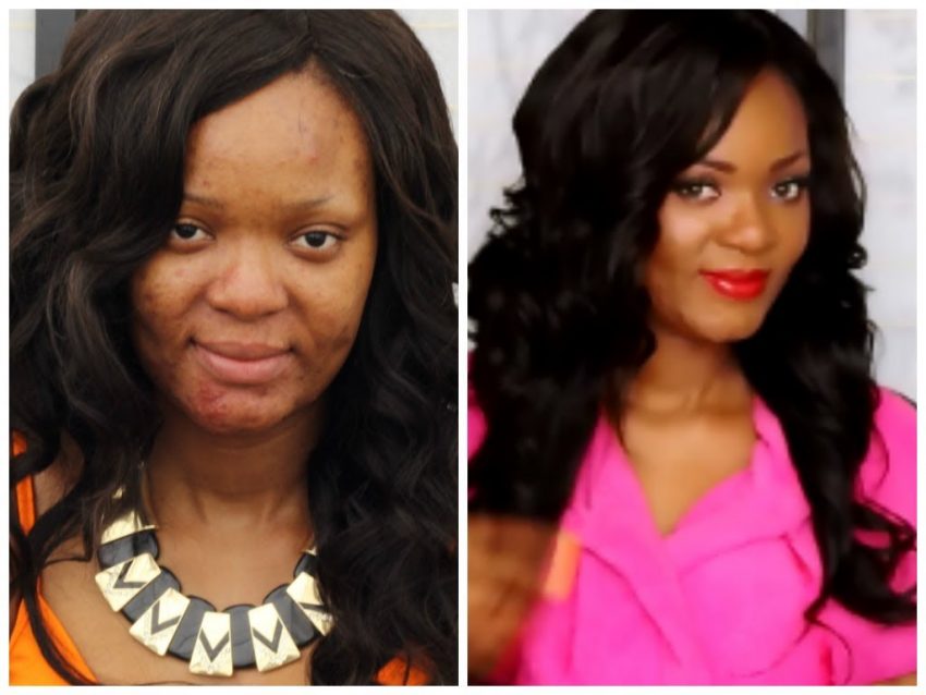 2026 How To Cover Acne Bumps Or Scars With Makeup – A Million Styles