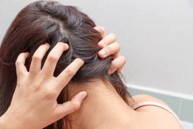 This Is The Reason Why Your Scalp Itches!