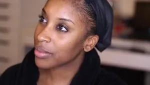 Hyperpigmentation of the Skin