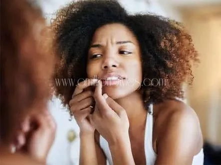 The Wonderful Use Of Bitterleaf For Pimples