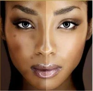 DIY Wednesday: Cheap And Simple Ways To Get Rid Of Black Spots At Home