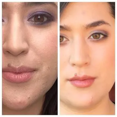 Are You Drinking Enough Water? Check Out Effects Of Dehydration On The Skin